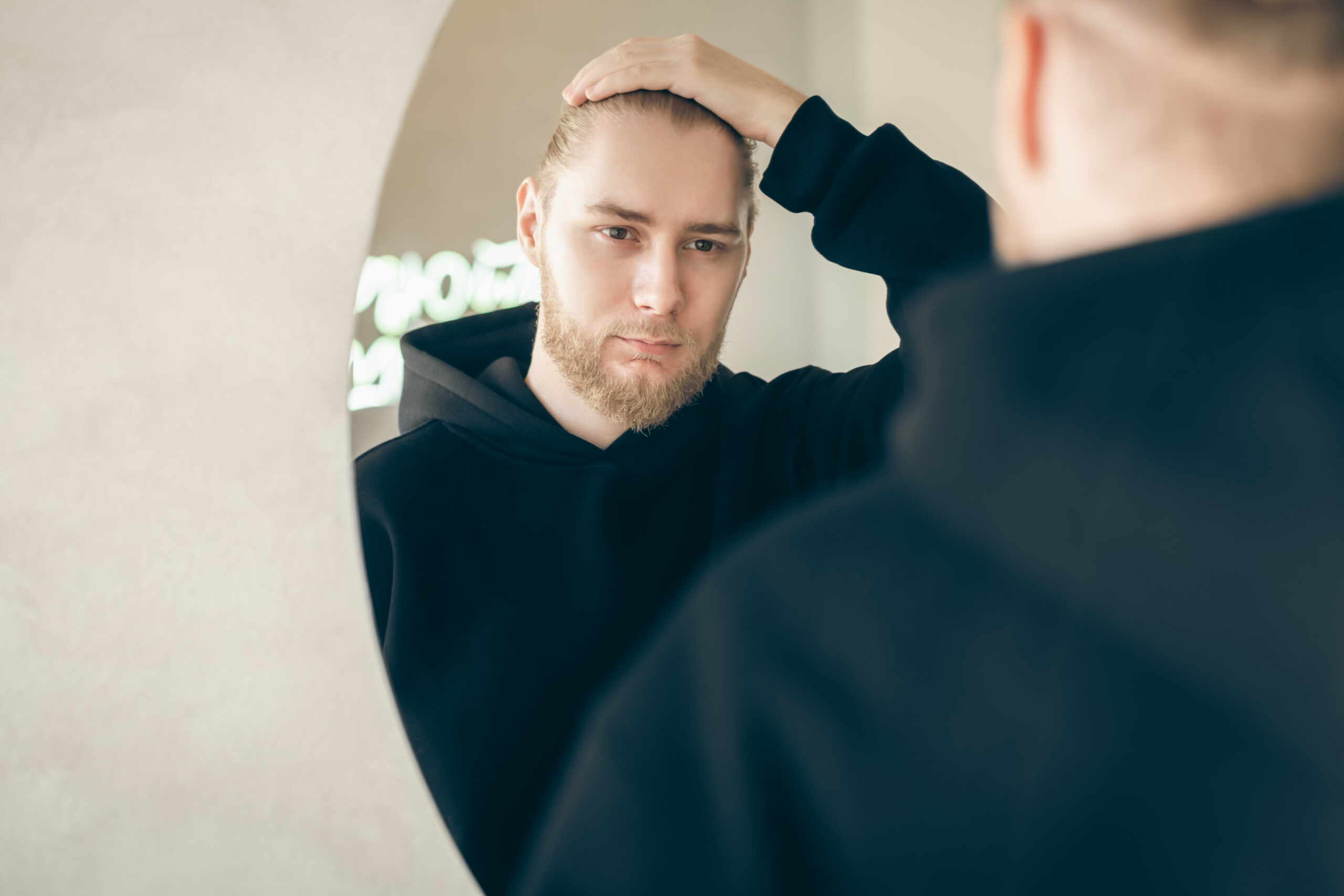 How Many Hair Transplants Can A Person Have? Is a Second Hair Transplant Doable?
