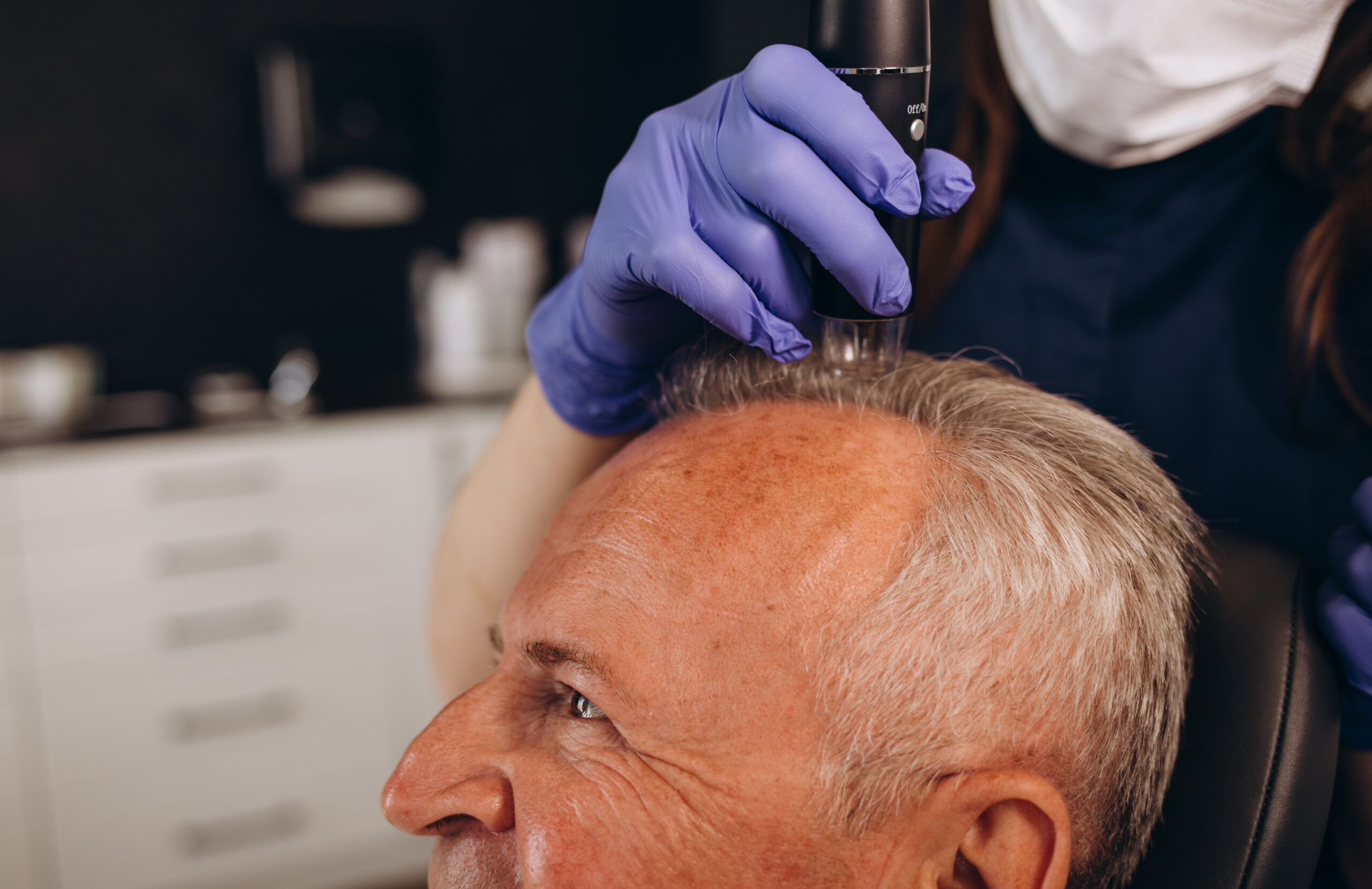 The Science Behind Hair Transplants: FUE vs. FUT Explained