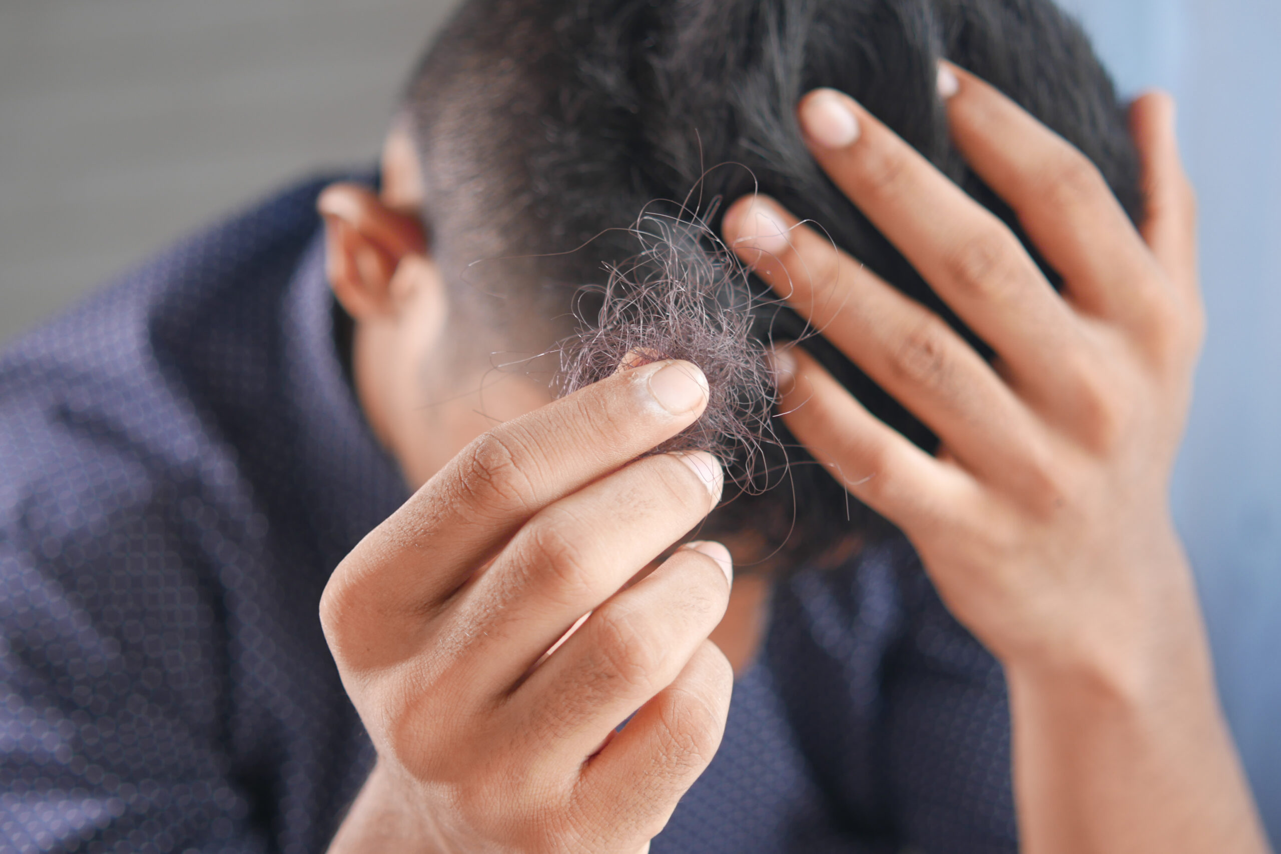 The Truth About Hair Loss: Causes and Solutions